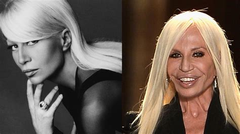 donatella versace gesicht